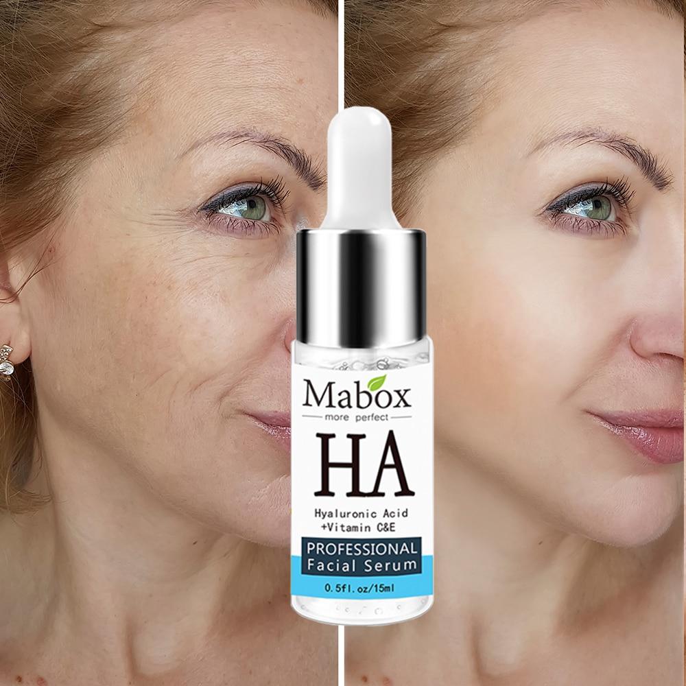 MABOX Hyaluronic Acid