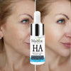 MABOX Hyaluronic Acid