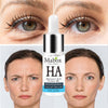 MABOX Hyaluronic Acid